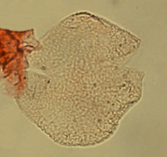 Mendicodinium mataschenensis.png